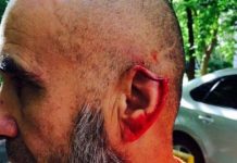 В Москве мигранту-дворнику за обычное замечание чуть не оторвали ухо