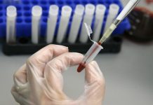 Согд: Число заболевших гепатитом А снизилось