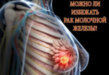 Можно ли избежать РМЖ?