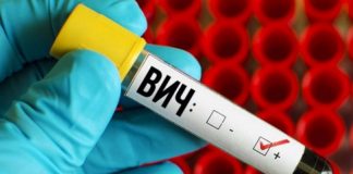 В 2019 году умерло 76 ВИЧ-инфицированных больных